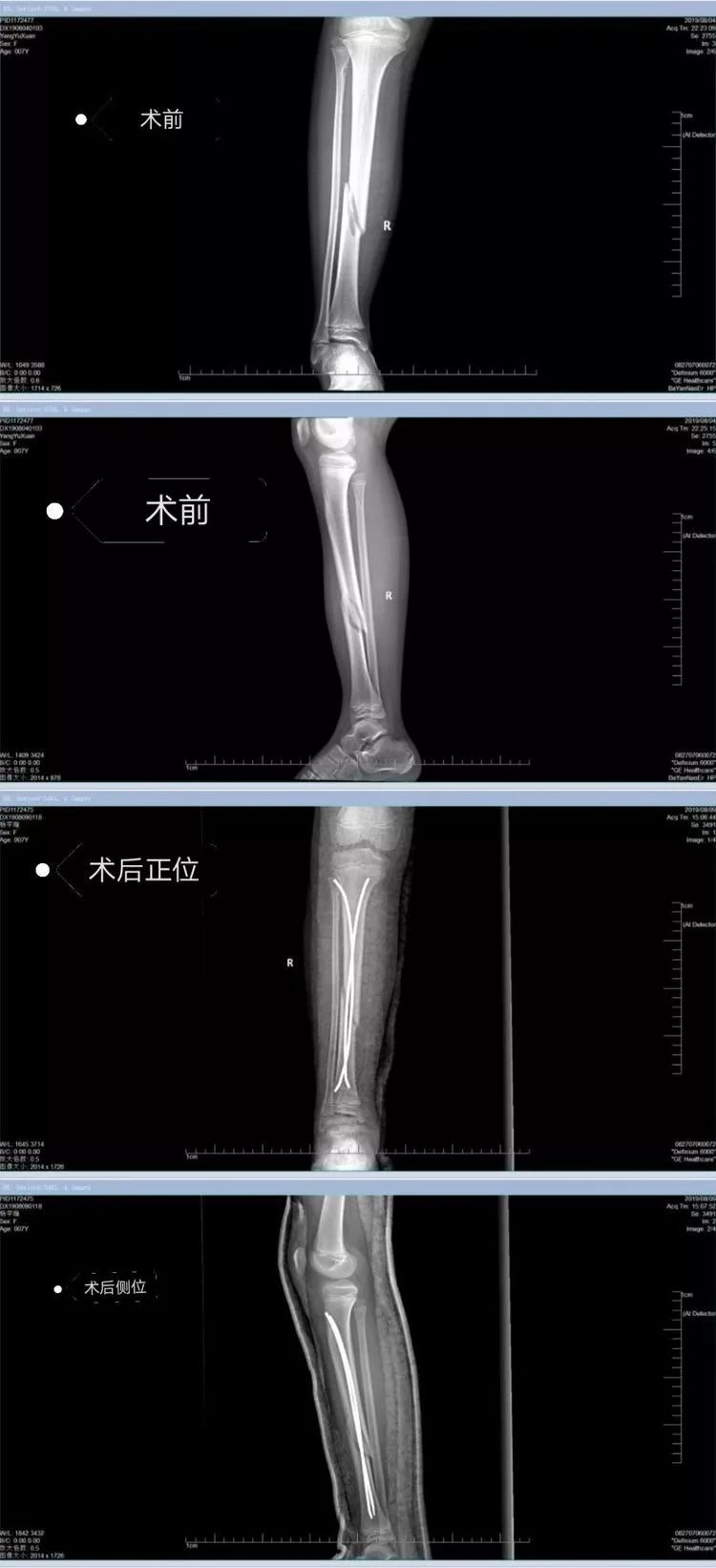 偉大的咻啦啦砰 视频封面